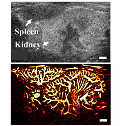 High Frequency Ultrafast Ultrasound Micro Doppler Imaging For